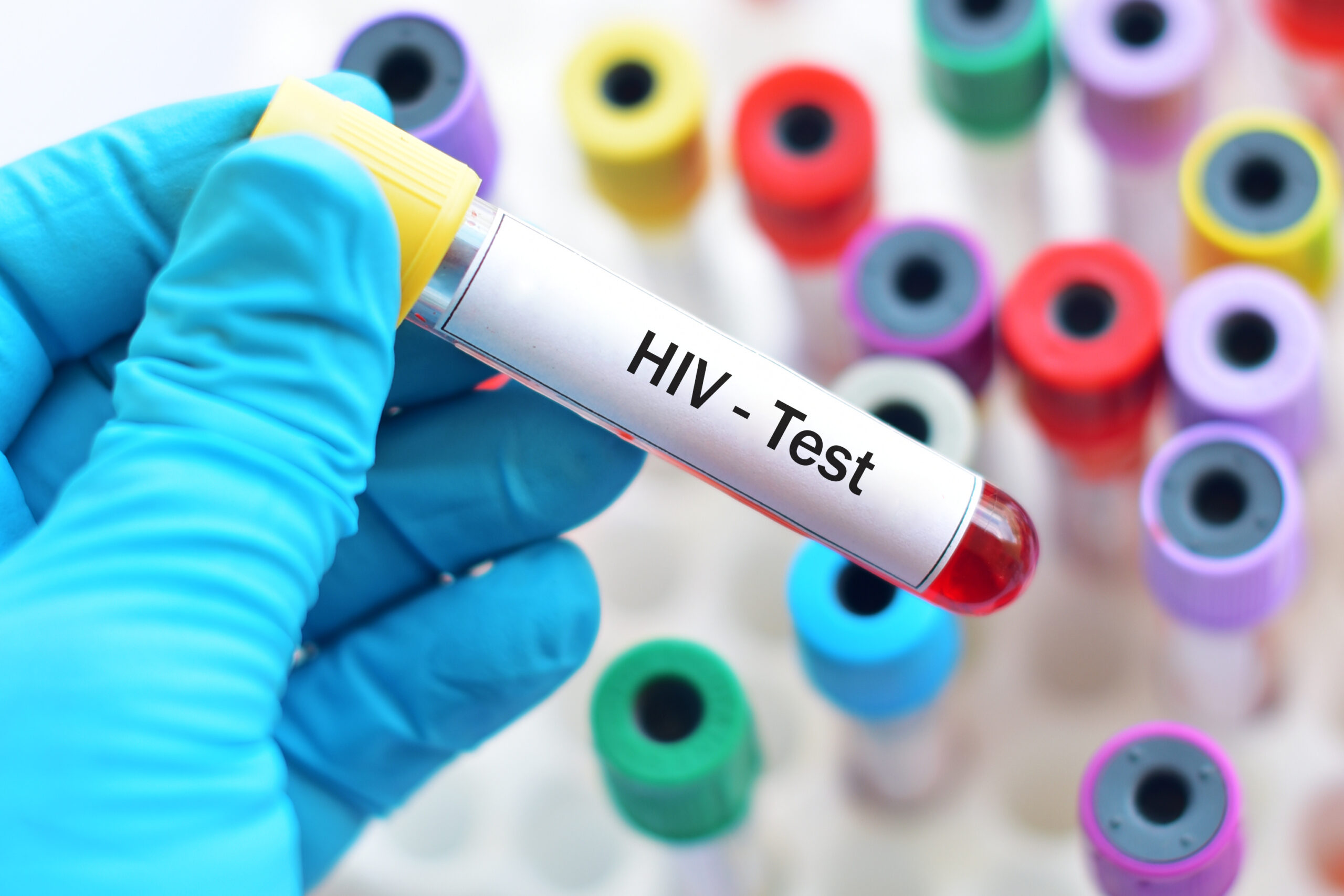 Blood HIV test